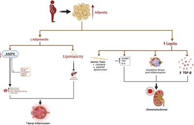 Obesity-related kidney disease: Beyond hypertension and insulin-resistance